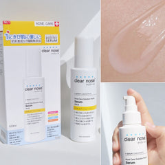 Clear Nose Acne Care Solution Facial Serum