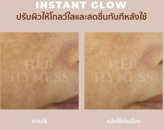 Her Hyness Instant Glow Black Mask