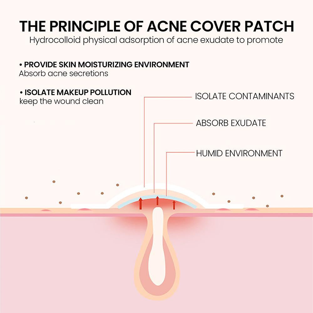 JaySuing Acne Cloud Patch